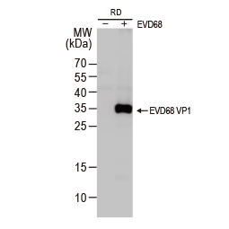 Enterovirus D68 VP1 antibody (GTX132313)