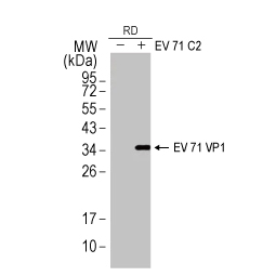 Enterovirus 71 VP1 antibody [HL1928] (GTX637687) 
