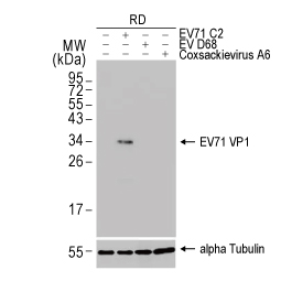 Enterovirus 71 VP1 antibody [HL1929] (GTX637688)